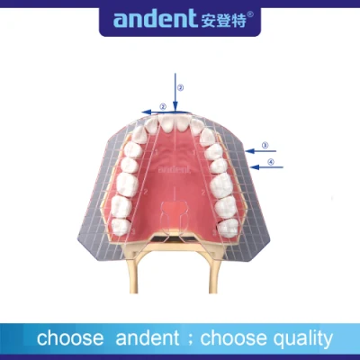 Plaque de guidage transparente dentaire des dents